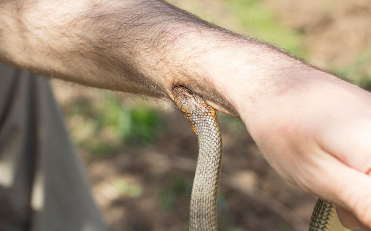 งูกัดแขน